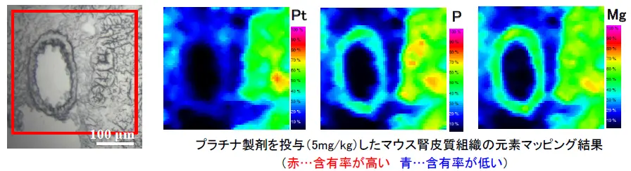 プラチナ製剤を投与したマウスの腎皮質組織マッピング