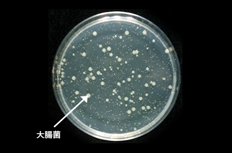 通常のステンレス（大腸菌）