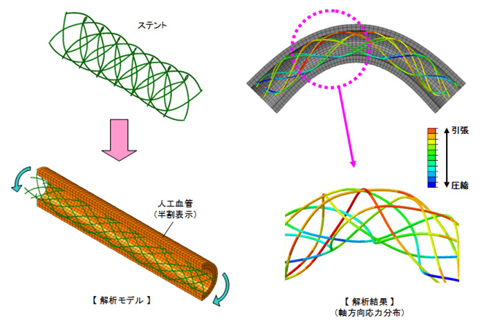 ステントの曲げ応力解析