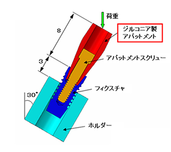 インプラント解析モデル