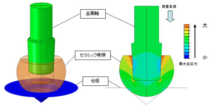 セラミック骨頭の圧縮試験 / 最大主応力分布