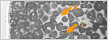 Analysis of microstructures, deteriorations/failures