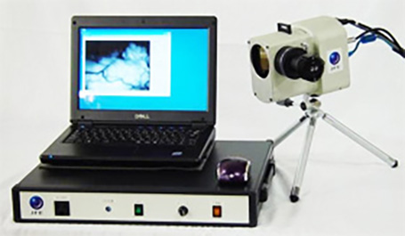 Appearance of skin analysis system