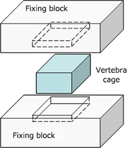 Vertebra cage and fixing blocks