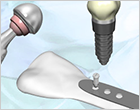 Evaluation of Medical Equipment/Implant Materials