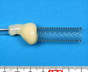 写真　試料電極（ステント）