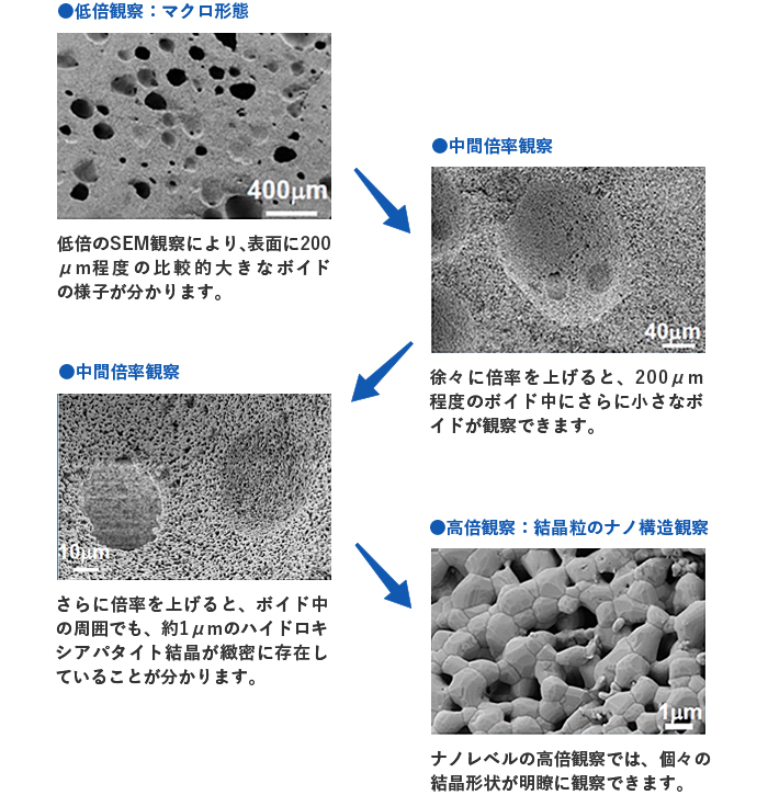 人工骨充填材の観察