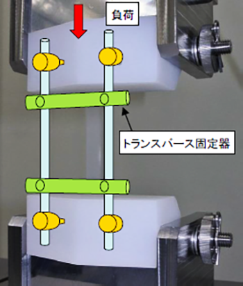 脊椎固定システムの圧縮荷重測定方法
