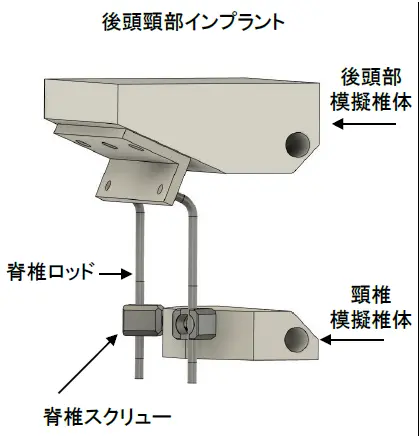 後頭頸部インプラント