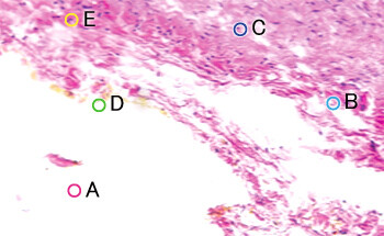 図1 染色したラットの癌組織の分光画像（擬似カラー化）