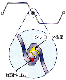 図1 止水材の装填充填