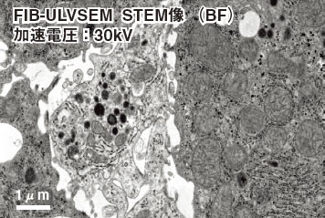 図1 ミクロトームによって作製したマウス肝臓のSTEM写真