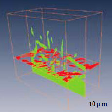 図2　図1の3次元構築像中に示した位置における マイクロスパイクの断層画像